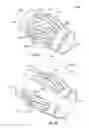Fig. 15 - Devices and methods for forming bow springs of one-piece centralizers