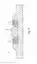 Fig. 05 - Downhole expandable tubular