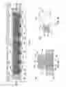 Fig. 03 - Prepacked sand screen assemblies