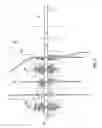 Fig. 02 - Diagnostic lateral wellbores and methods of use
