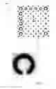 Fig. 03 - Morphological automatic Landolt C orientation detection