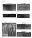 Fig. 32 - Method for propagating microorganisms within plant bioreactors and stably storing microorganisms within agricultural seeds