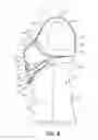 Fig. 09 - Garment for selectively supporting shields for expressing milk