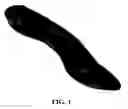 Fig. 02 - SYSTEMS AND METHODS FOR MAKING CUSTOM ORTHOTICS