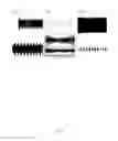 Fig. 05 - Method and System of Obstructed Area Determination for Sleep Apnea Syndrome