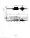 Fig. 06 - Method and System of Obstructed Area Determination for Sleep Apnea Syndrome
