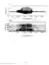 Fig. 07 - Method and System of Obstructed Area Determination for Sleep Apnea Syndrome