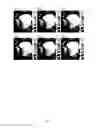 Fig. 08 - Method and System of Obstructed Area Determination for Sleep Apnea Syndrome