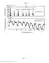 Fig. 09 - Method and System of Obstructed Area Determination for Sleep Apnea Syndrome