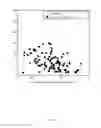 Fig. 10 - Method and System of Obstructed Area Determination for Sleep Apnea Syndrome