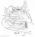 Fig. 09 - Devices for therapeutic nasal neuromodulation and associated methods and systems
