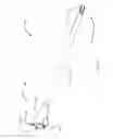 Fig. 15 - Bone screw and implant delivery device