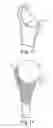 Fig. 08 - Intra-articular joint replacement and method