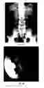 Fig. 02 - Enterically coated cysteamine, cystamine and derivatives thereof