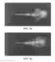 Fig. 02 - Cardiac myofibril induction