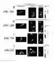 Fig. 33 - COMPOSITIONS OF NUCLEIC ACID-CONTAINING NANOPARTICLES FOR IN VIVO DELIVERY