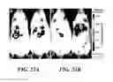 Fig. 35 - COMPOSITIONS OF NUCLEIC ACID-CONTAINING NANOPARTICLES FOR IN VIVO DELIVERY