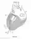Fig. 02 - Cardiac treatment system