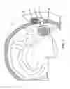 Fig. 02 - Cortical visual prosthesis