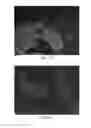 Fig. 06 - Anti-p40 antibodies systems and methods