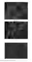 Fig. 07 - Anti-p40 antibodies systems and methods