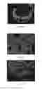Fig. 16 - Anti-p40 antibodies systems and methods