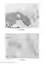 Fig. 25 - Anti-p40 antibodies systems and methods