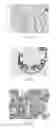 Fig. 35 - Anti-p40 antibodies systems and methods
