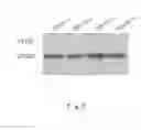 Fig. 06 - NANOZYME IMMUNOCHROMATOGRAPHIC DETECTION METHOD