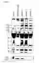 Fig. 02 - Microparticle fractionation
