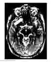 Fig. 01 - Apparatus and method for improving balanced steady-state free precision in magnetic resonance imaging