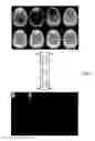 Fig. 06 - Apparatus and method for improving balanced steady-state free precision in magnetic resonance imaging