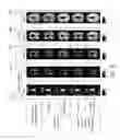 Fig. 09 - Generalized spherical deconvolution in diffusion magnetic resonance imaging