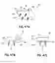 Fig. 35 - Clip assembly for use holding sinuous springs