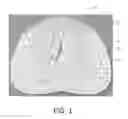 Fig. 02 - Motorized optical imaging of prostate cancer