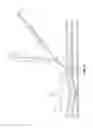Fig. 06 - Monorail system for vascular closure device and methods