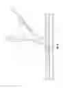 Fig. 07 - Monorail system for vascular closure device and methods