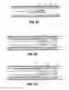 Fig. 45 - Endoscopic surgical clip applier