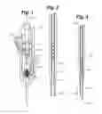 Fig. 02 - CATHETER SYSTEM FOR LEFT HEART ACCESS