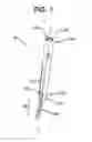 Fig. 02 - Methods and devices for minimally invasive spinal fixation element placement