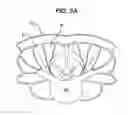 Fig. 07 - Methods and devices for minimally invasive spinal fixation element placement