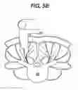Fig. 08 - Methods and devices for minimally invasive spinal fixation element placement