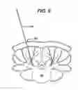 Fig. 09 - Methods and devices for minimally invasive spinal fixation element placement
