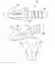 Fig. 01 - Intramedullary anchor for interphalangeal arthrodesis
