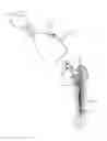 Fig. 01 - Method and apparatus for extraction of medical implants