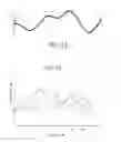 Fig. 09 - Method and apparatus for extraction of medical implants