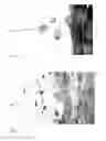 Fig. 02 - Vertebral body end-plate microparticulate composition and uses thereof