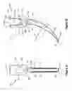 Fig. 02 - Arcuate fixation member