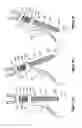 Fig. 06 - Arcuate fixation member