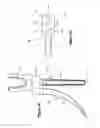 Fig. 07 - Arcuate fixation member
